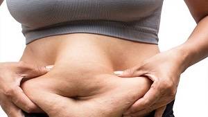 پیکرتراشی اقساطی در مشهد