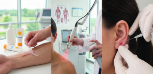 درمان اسکار و کلوئید بعد جراحی